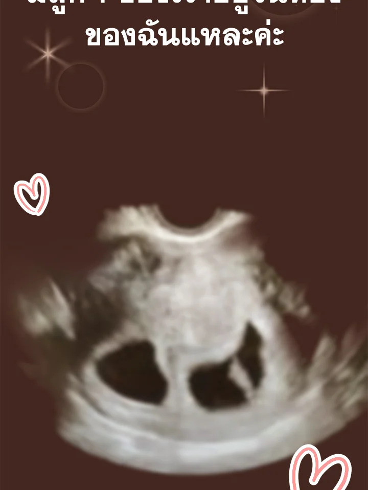 ความสัมพันธ์นี้ไม่ดีต่อใจ | On Bad Terms ตอนที่ 48 - รูปที่ 2